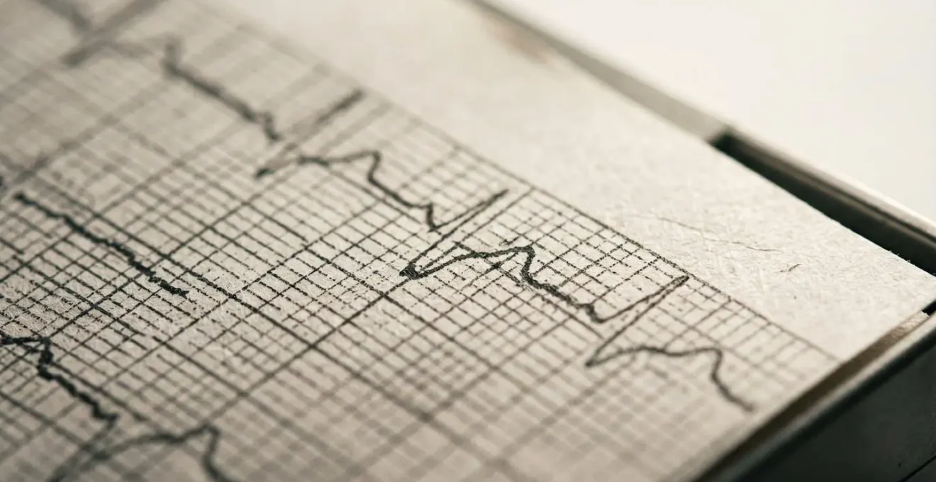 Visualisation macro des battements d'un électrocardiogramme représentant la volatilité saine des marchés financiers
